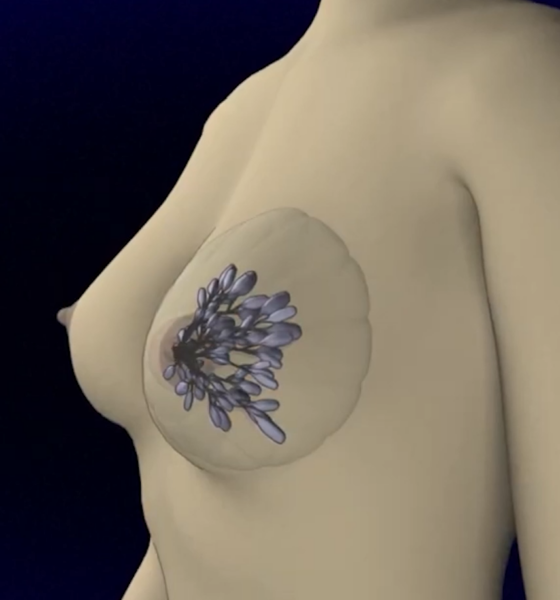 fr2 Cancer du sein : Tout savoir avec le Docteur YAMÉOGO