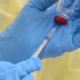 cap3 Infos en langue nationale/ Mooré: Le virus d'ébola en RDC et en Ouganda